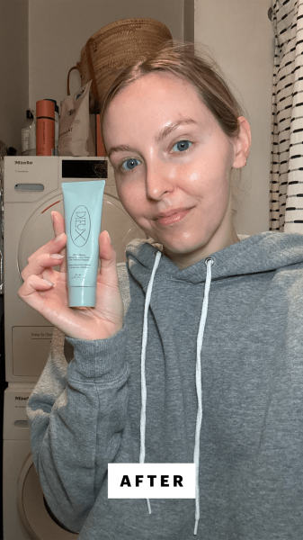 Kinonen after applying the Dieux Skin Mercy Intense Recovery Cream