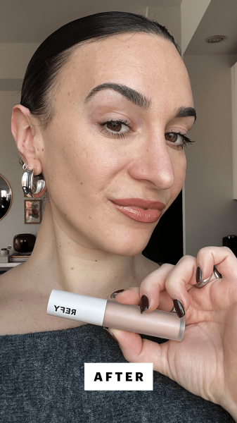 Wohlner after applying the Refy Concealer