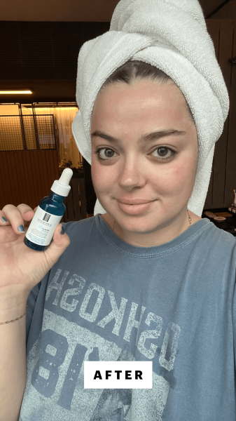 Hoffmann after applying the La RochePosay Hyalu B5 Pure Hyaluronic Acid Serum