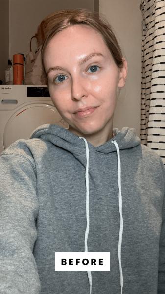 Kinonen before applying the Dieux Skin Mercy Intense Recovery Cream