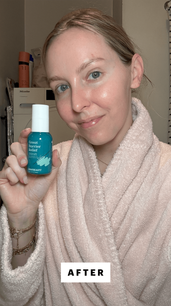 Kinonen after applying the KraveBeauty Barrier Relief Serum